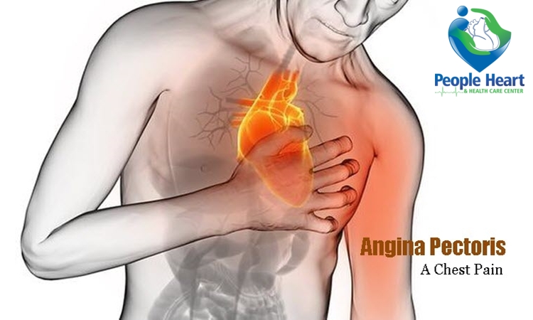 What is Angina | Symptoms and Types of Angina | How to Prevent it?