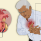 What is heart attack, Types of Heart Attack
