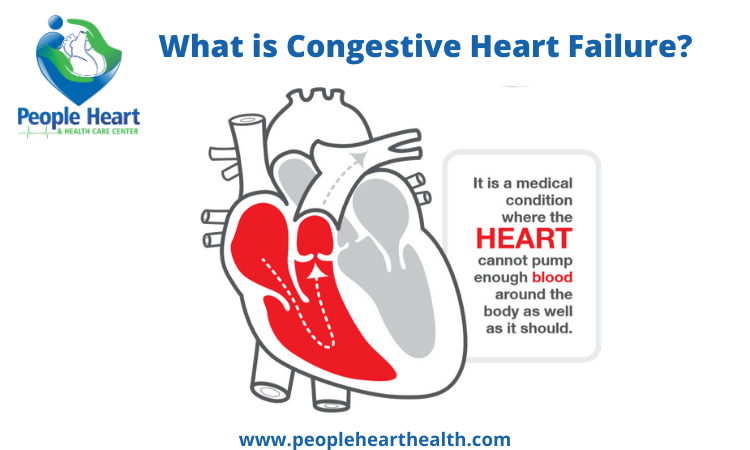 What is Congestive Heart Failure or CHF – Symptoms and Causes